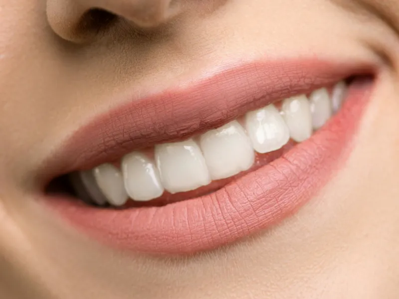 Sorriso com dentes mais brancos após clareamento dental