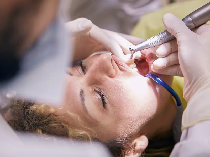 Procedimento de limpeza dental profissional com instrumento de profilaxia